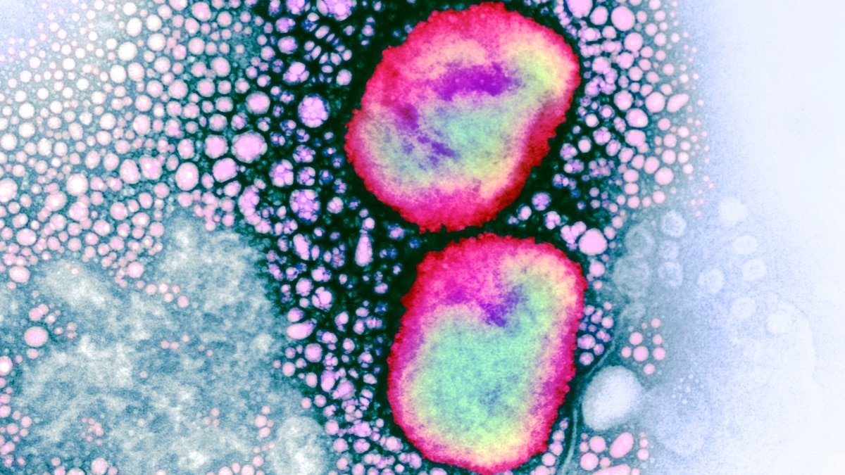 WHO declares mpox a global health emergency WHO declares mpox a global health emergency