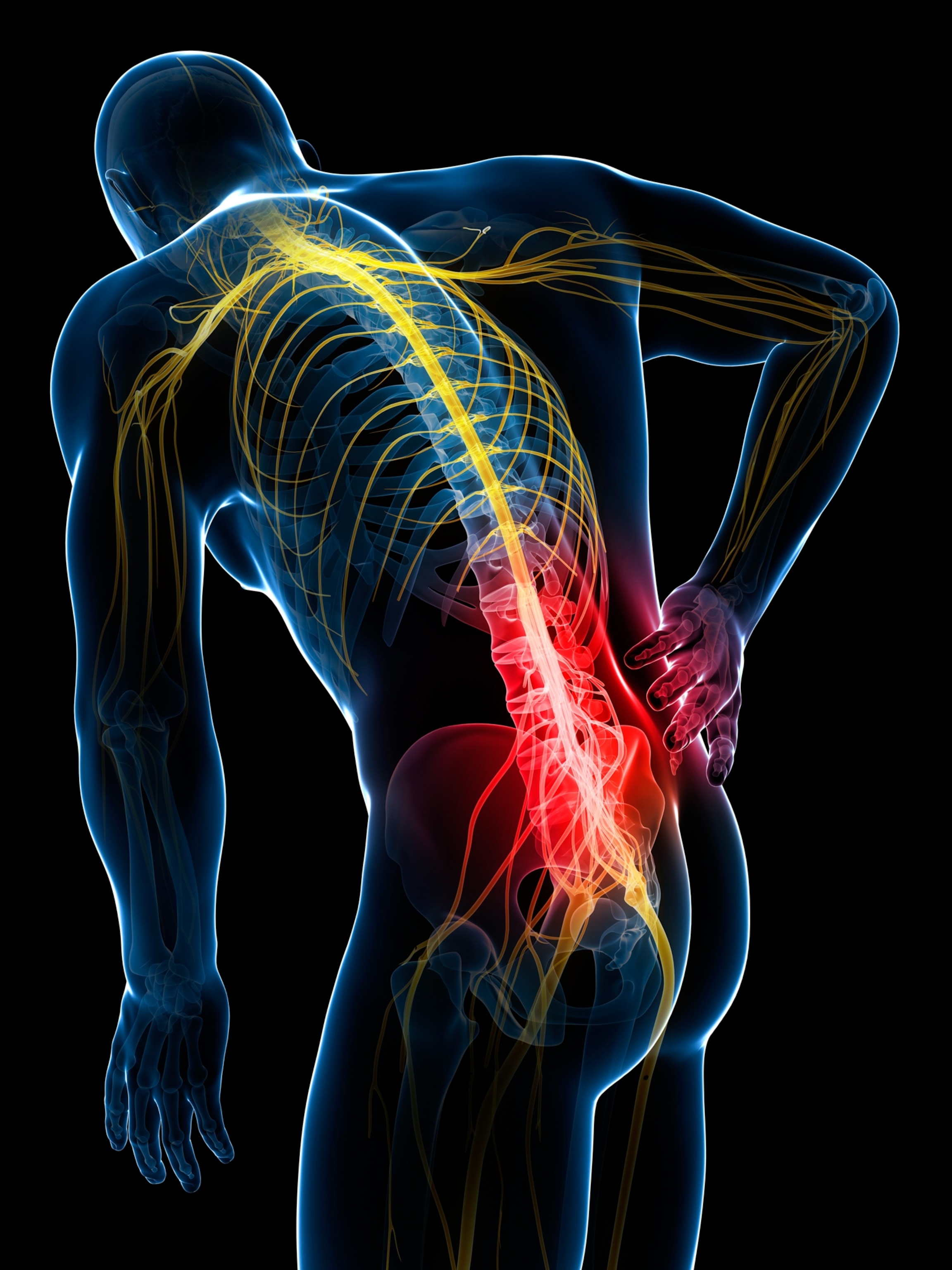 X-ray style illustration of a human with highlighted spine and nerves showing lower back pain. The figure is bent forward, hand on back, with a red glow indicating pain.