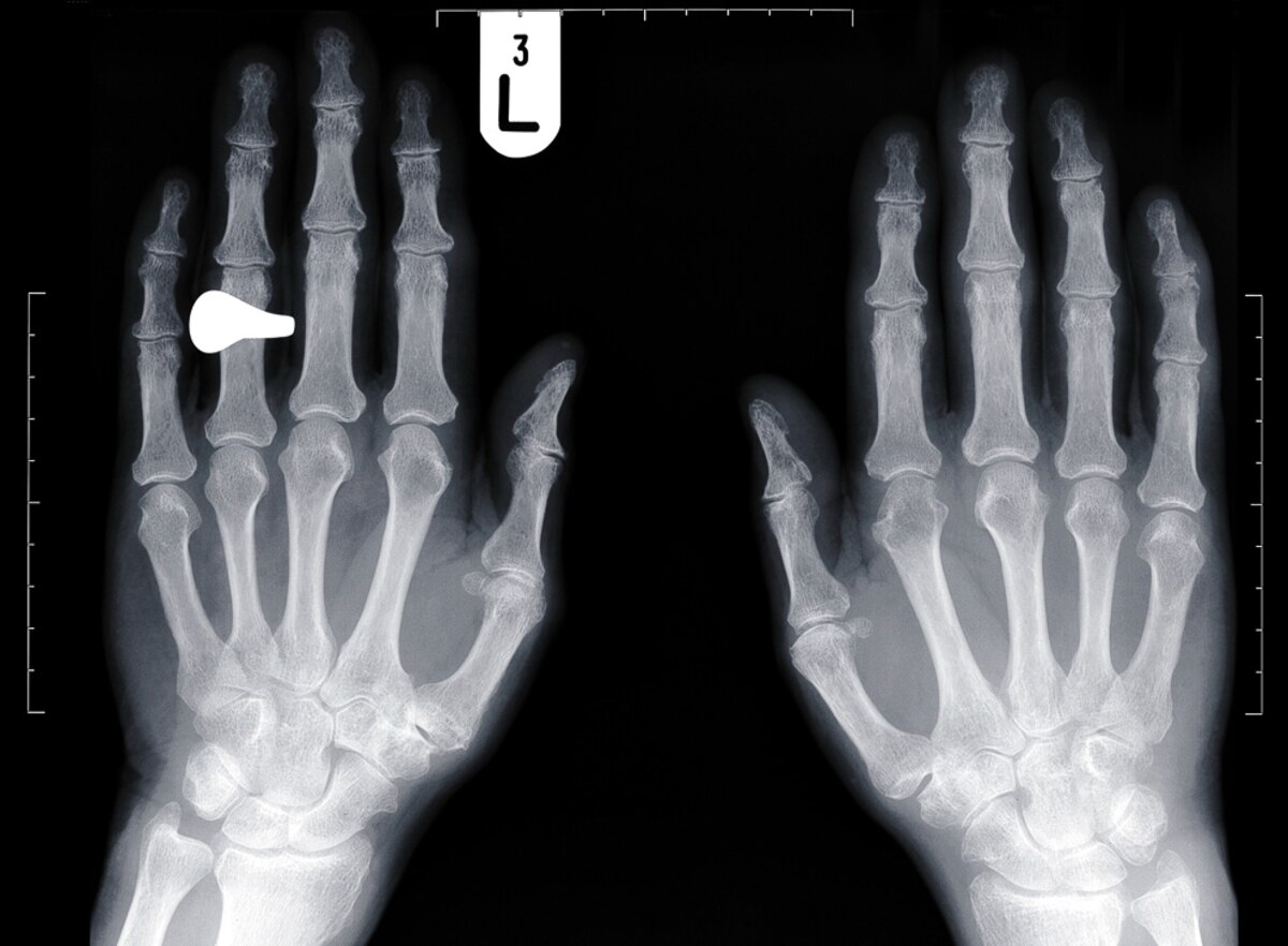 Why Most Men's Ring Fingers Are So Long