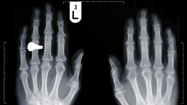 Why Most Men S Ring Fingers Are So Long