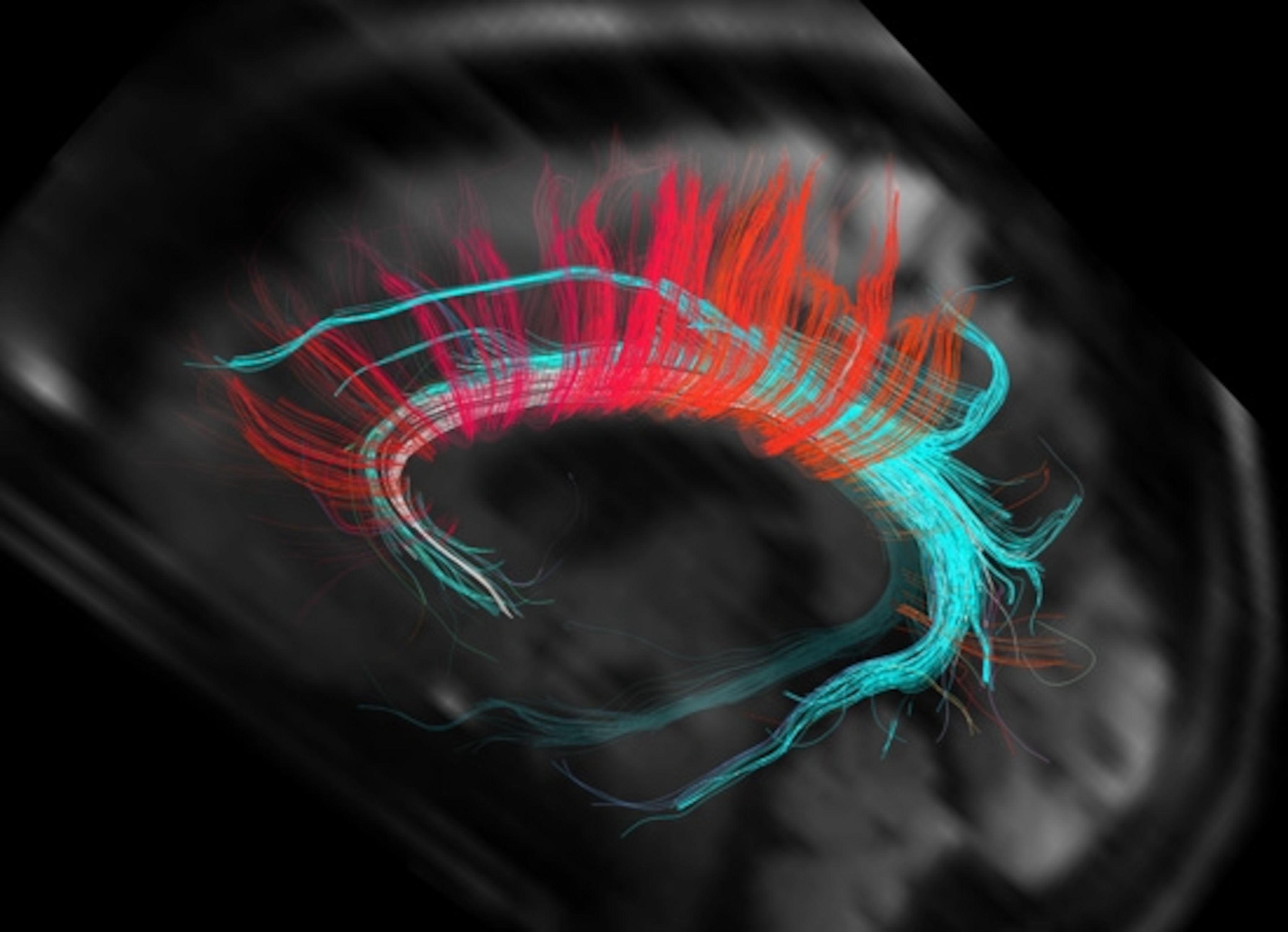 Some of the white-matter connections in my brain. (Thanks to Van Wedeen and colleagues at the Martinos Center for Biomedical Imaging)