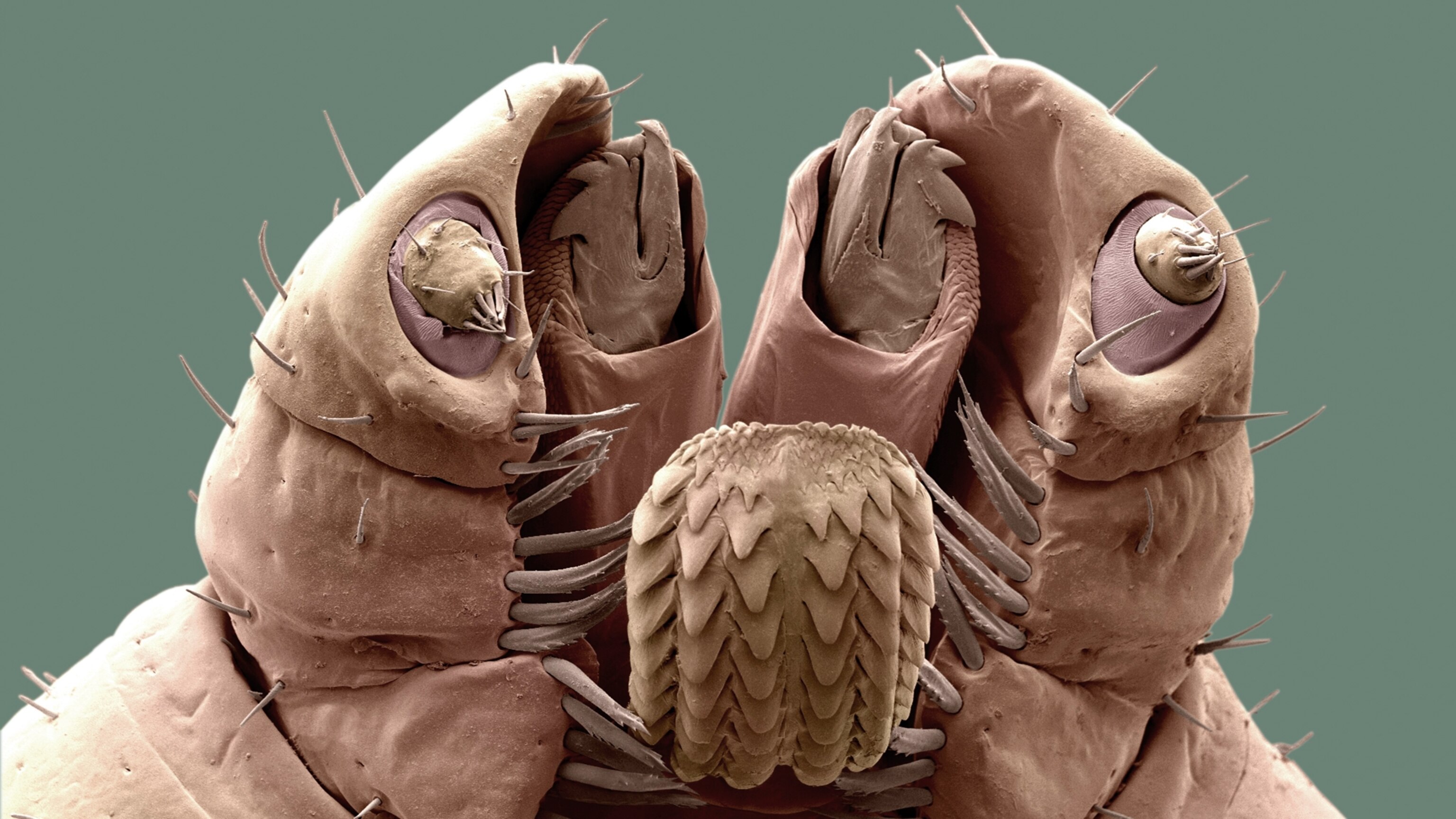 Why tick-borne diseases have reached 'epidemic proportions