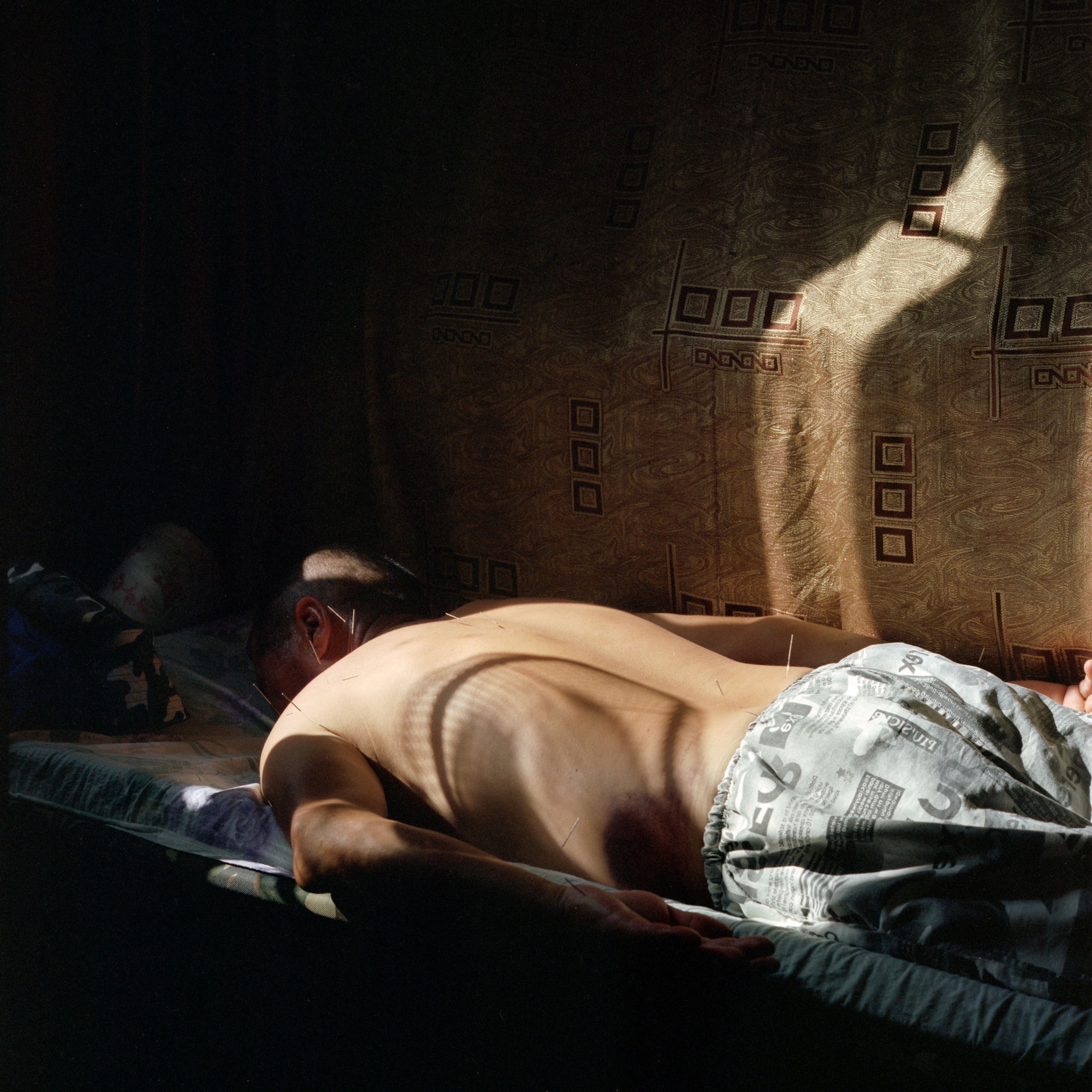 a Kazakh man receives acupuncture treatment in a temporary clinic