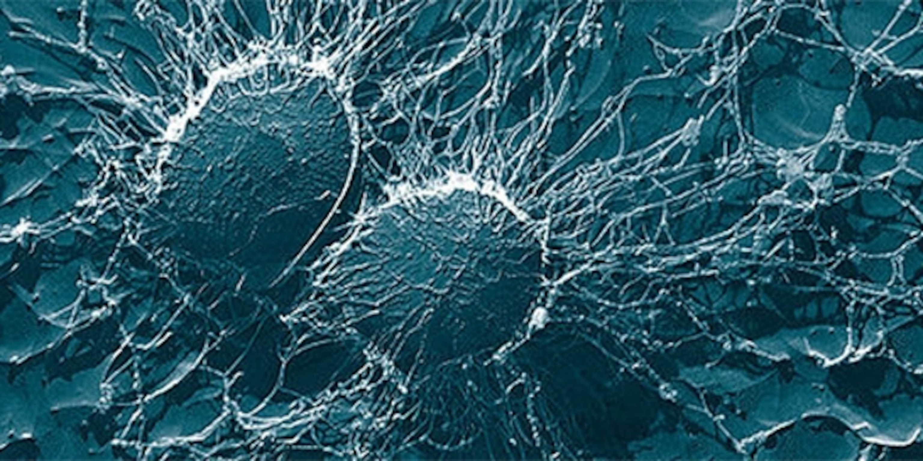 Staph Bacteria'S Secret Weapon: Targeting Milady - 7tosung