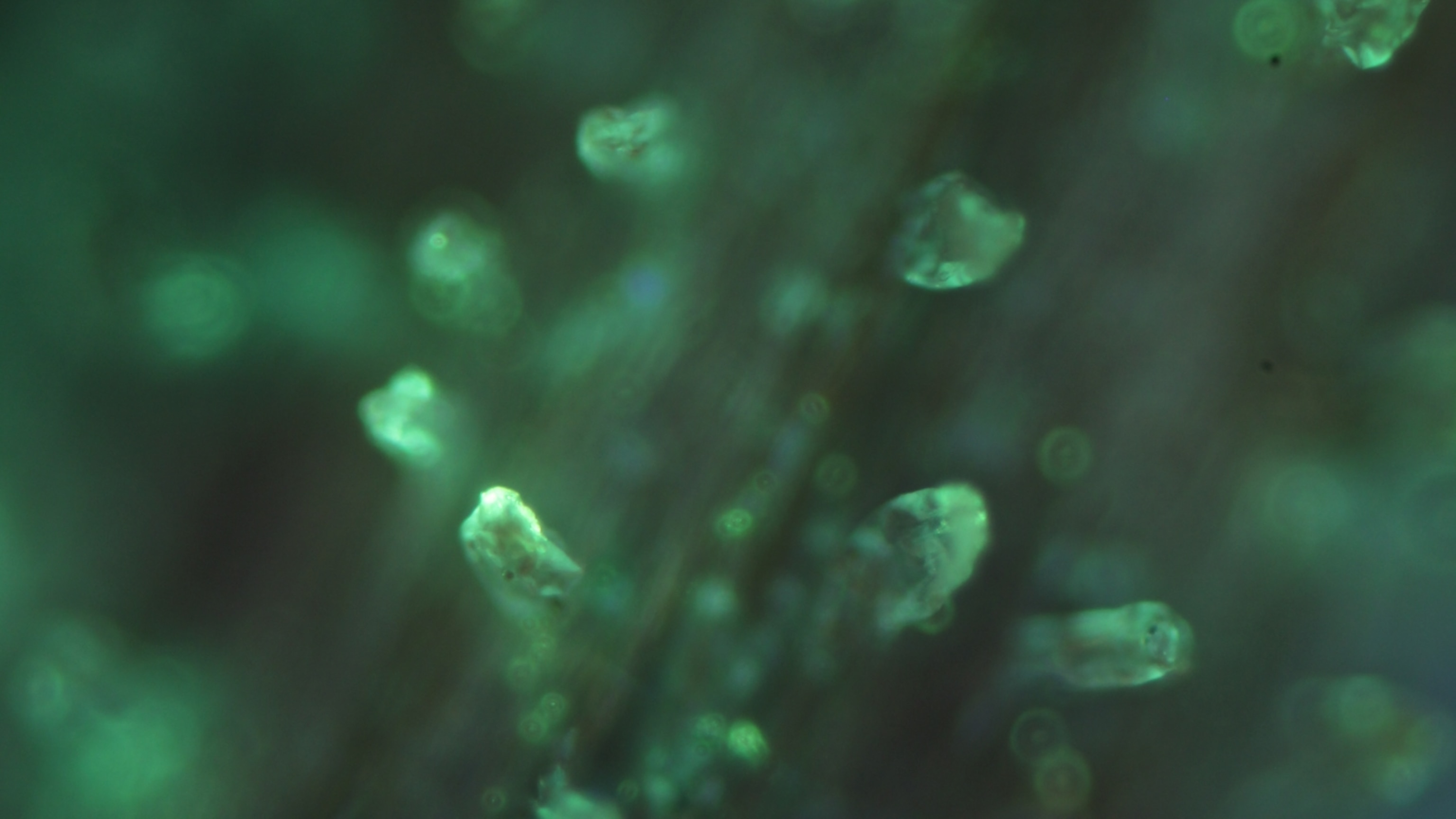 Glandular_hairs_of_Triantha_occidentalis_stained_with_phosphatase_substrate_under_epifluorescence_16x9.jpg