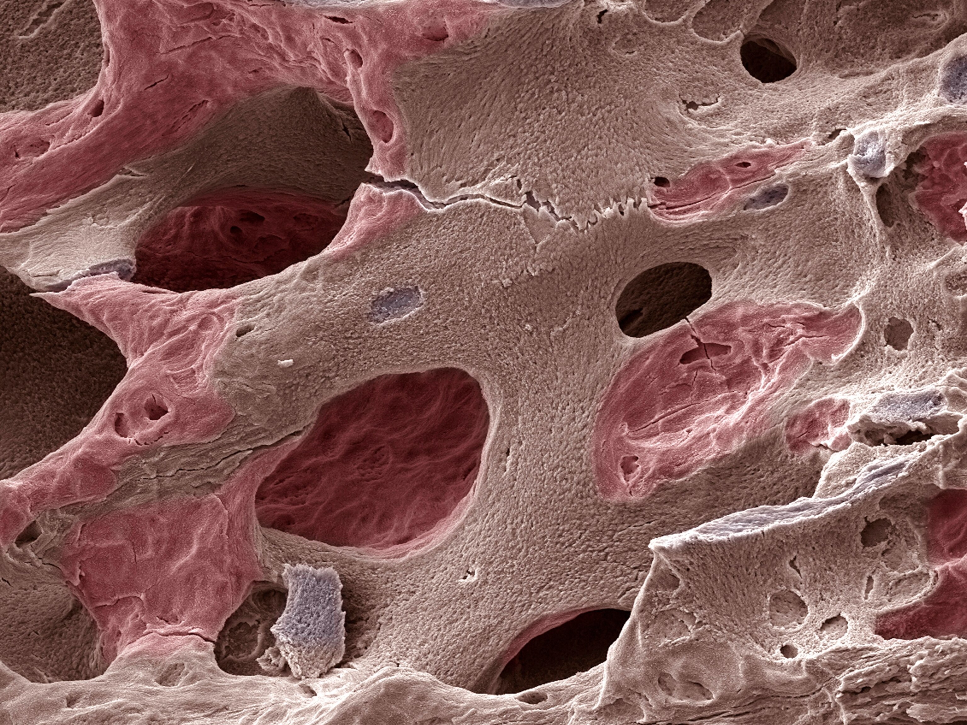 Lifting heavy weights can help you mitigate osteoporosis. Here’s how to