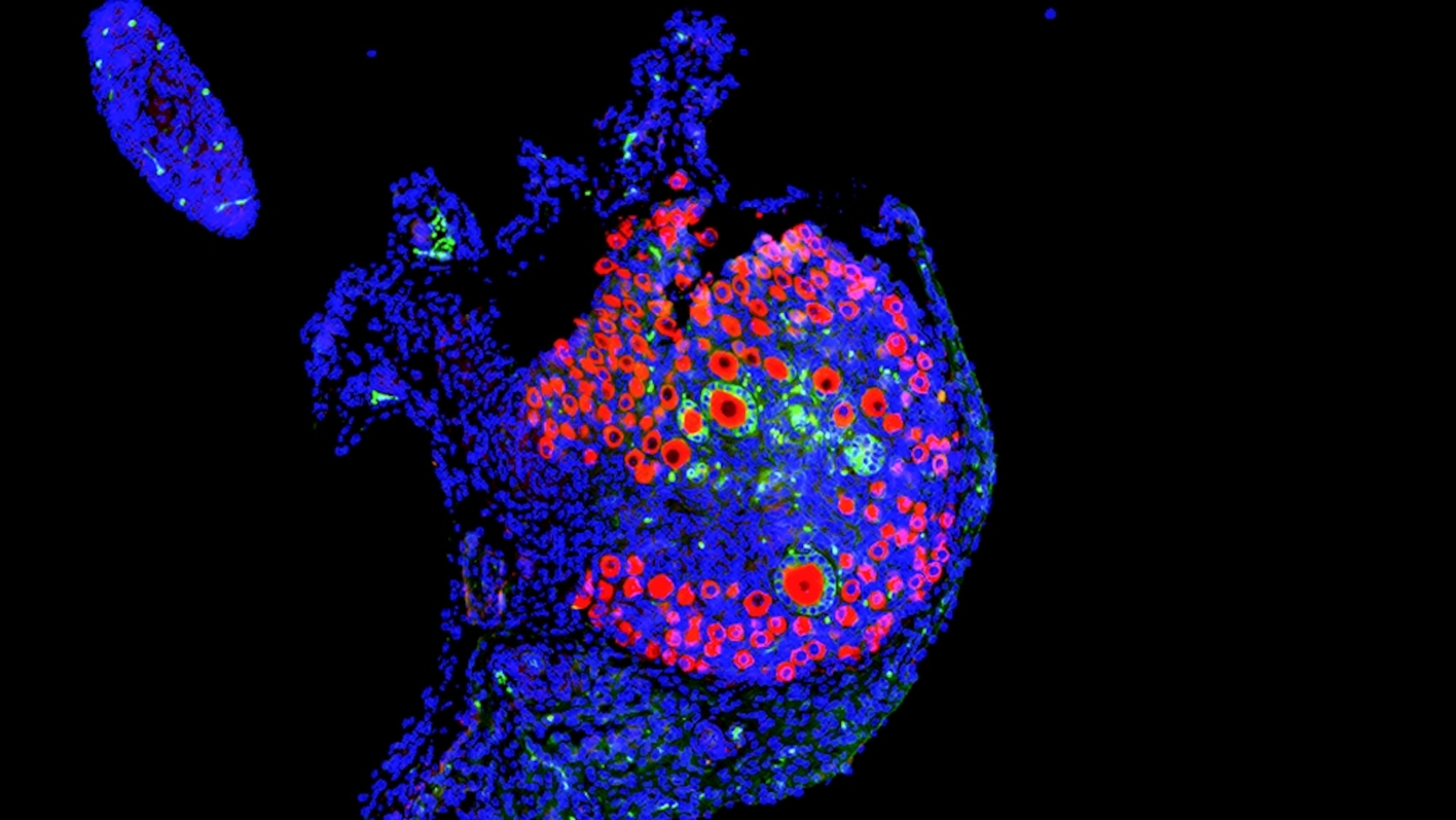 Why ovaries are so crucial to women’s health and longevity