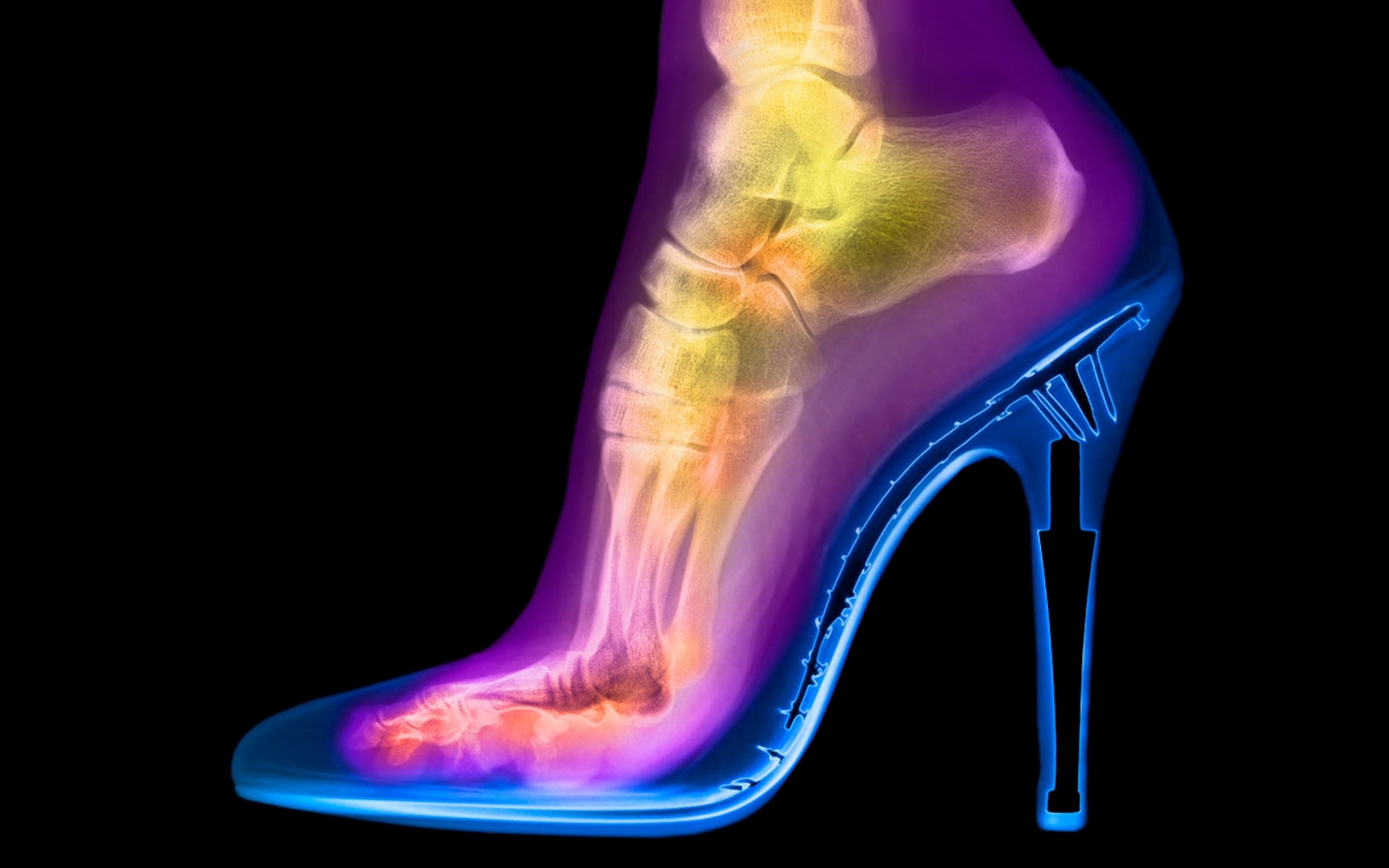 womans foot x-ray high heels