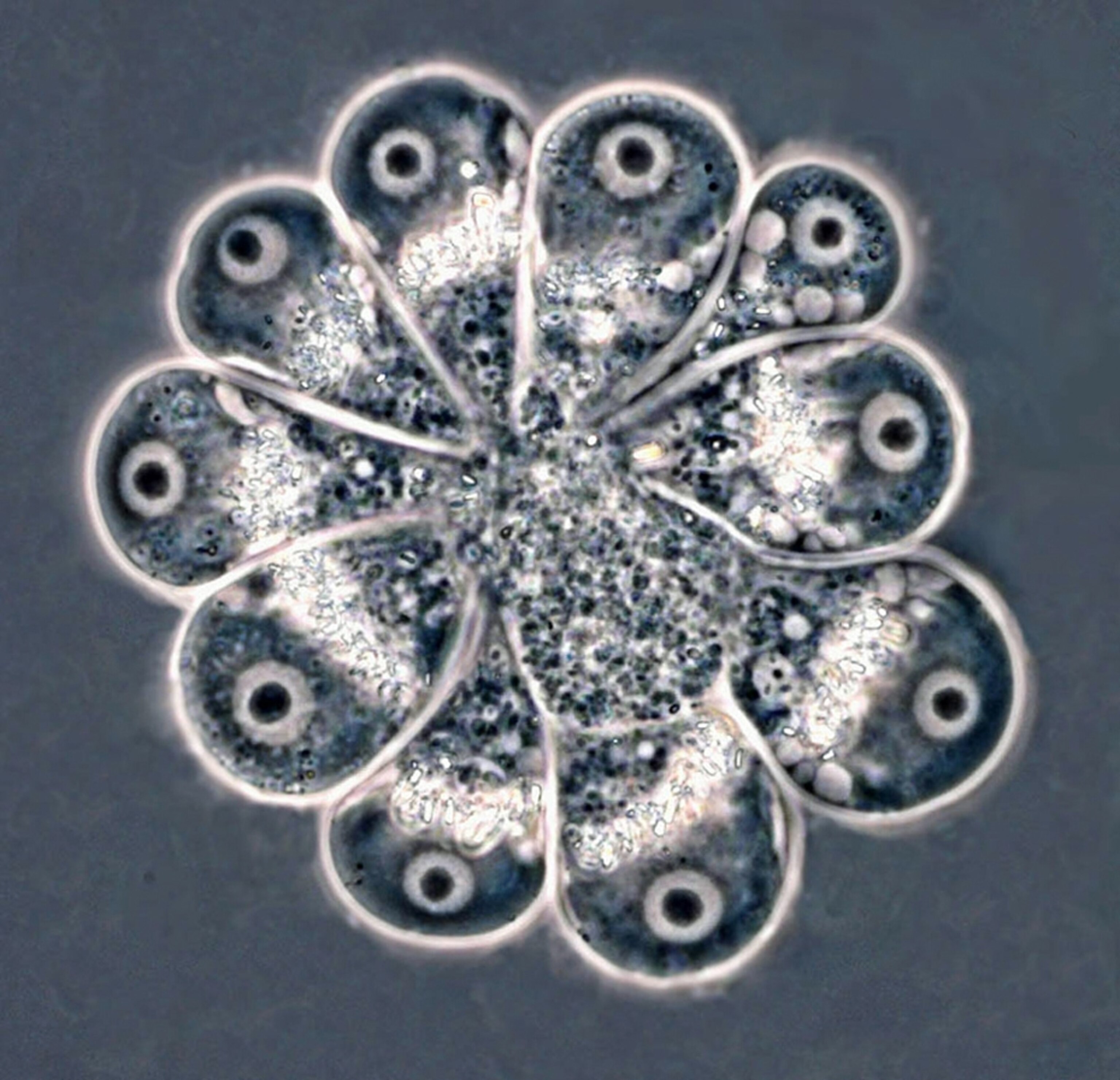a cluster of Chlamydophrys amoebas, inventoried as part the Census of Marine Life's study of hard-to-see sea creatures