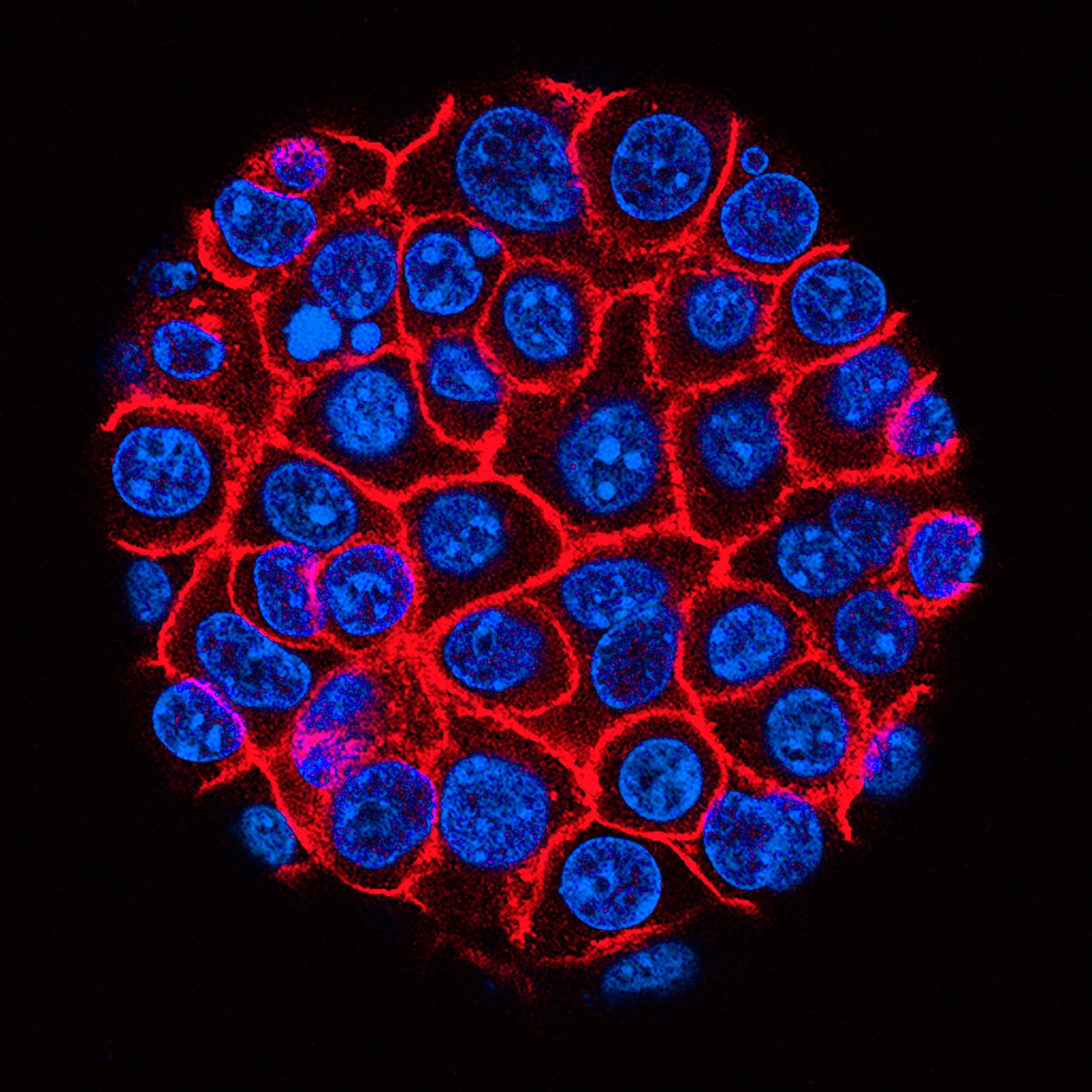 Microscopic image of human skin cells with blue nuclei surrounded by red cell membranes on a black background