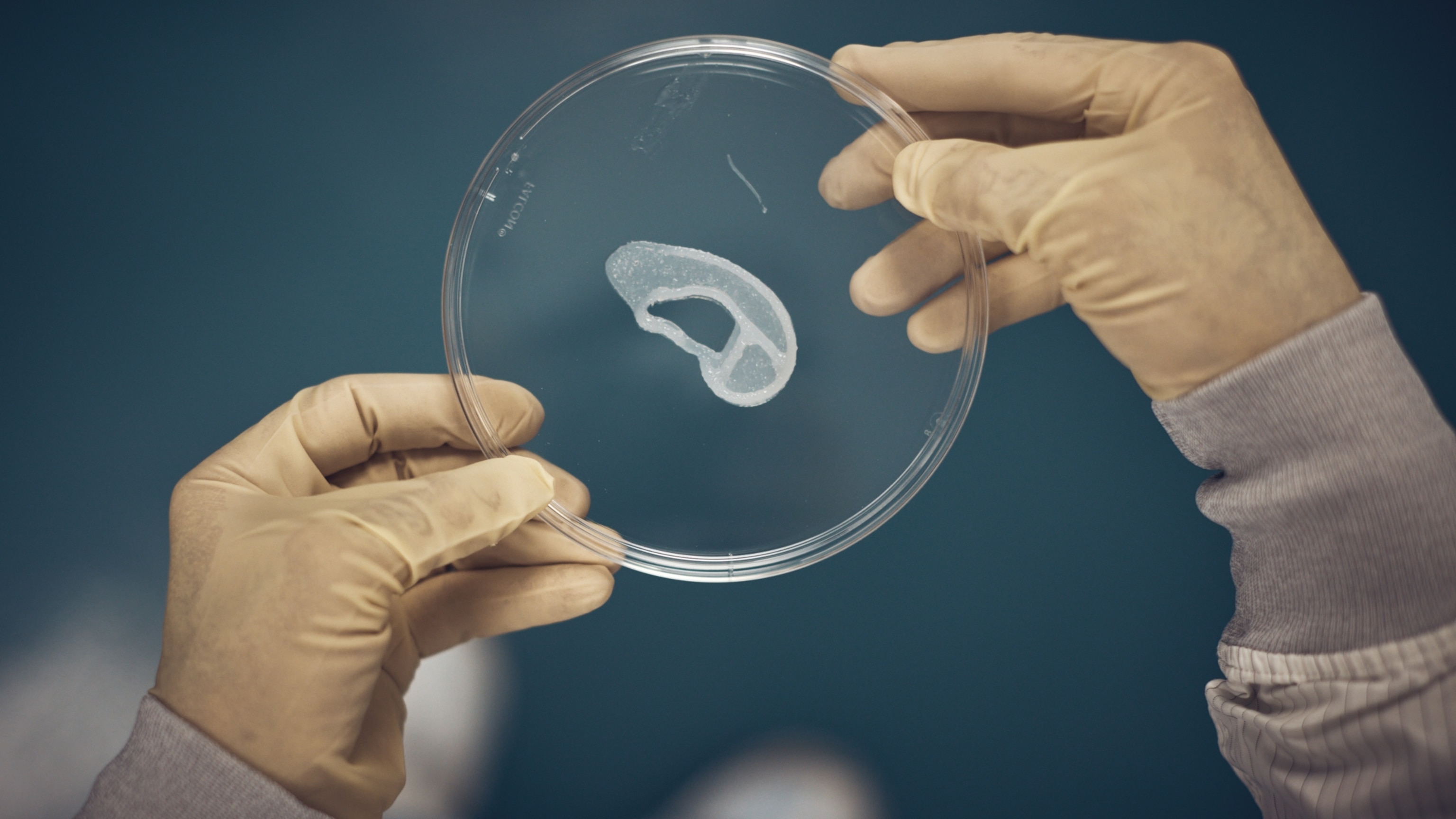 Doctors have long said cartilage can’t regenerate. They're now rethinking that.