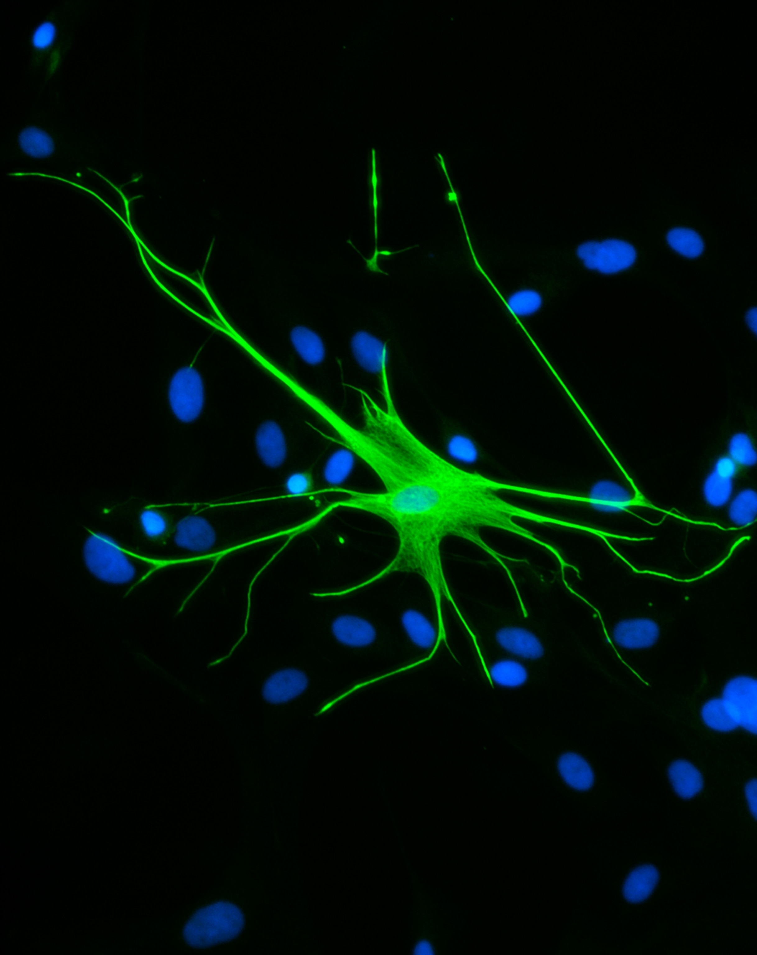 Fluorescent microscopy image of a green neuron with branching dendrites amid scattered blue cell nuclei on a black background