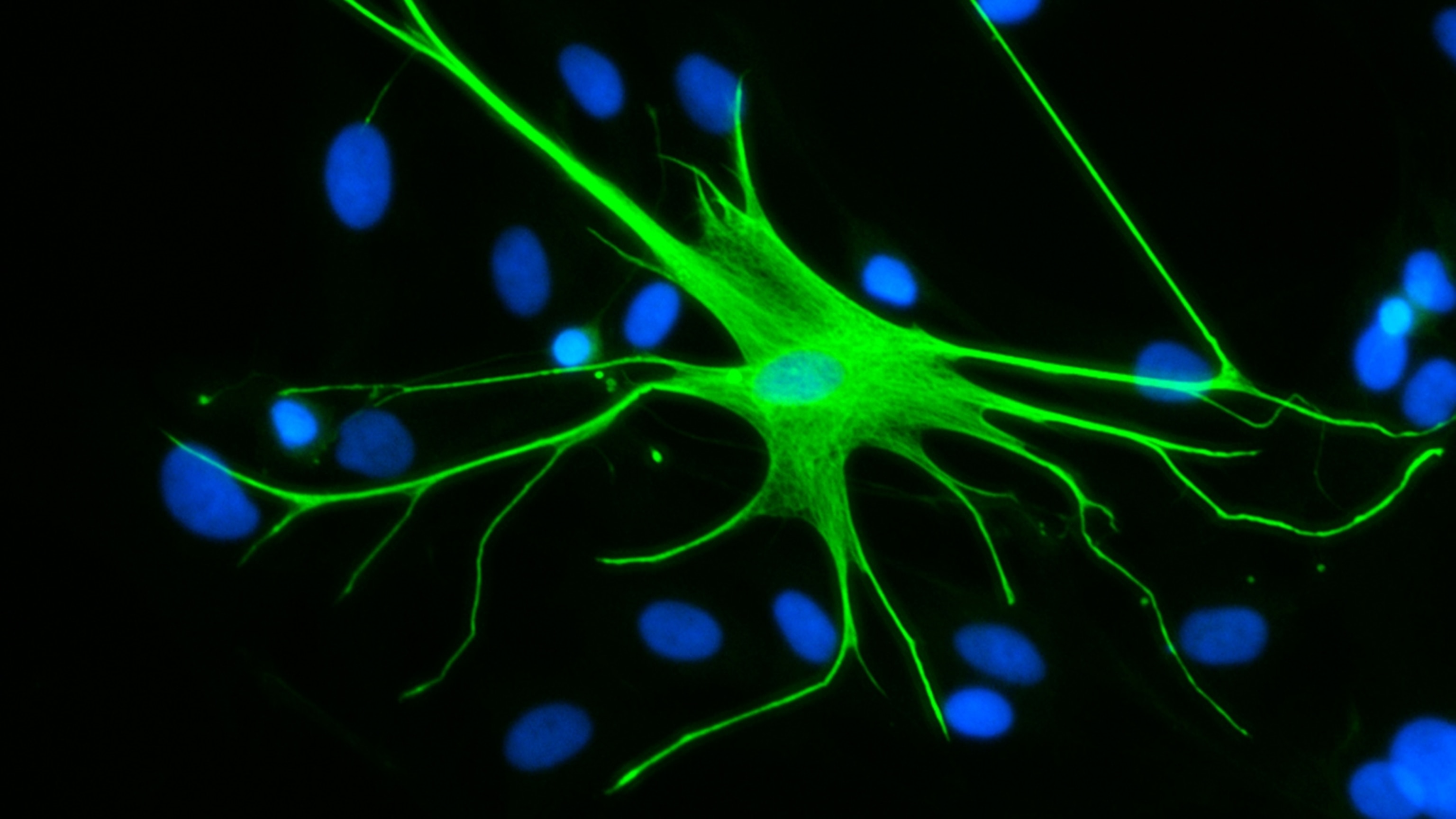 Are these overlooked brain cells the key to treating trauma and anxiety?